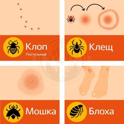 Дезенфекция дизенфекция дезинфекция дизинфекция dizinfeksiya