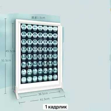 негатоскоп двухсекционный