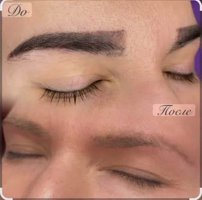 Удаление татуаж бровей удаление растушовку бровей