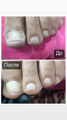 Мужской педикюр маникюр