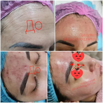 Косметолог эстет для всех! Все виды косметологических услуг