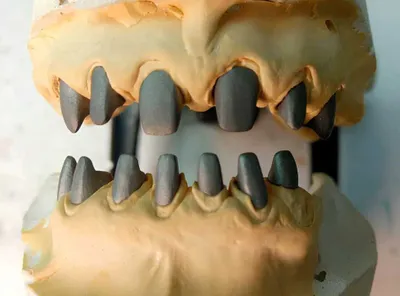 CAD/CAM – Цифровая зуботехническая стоматология