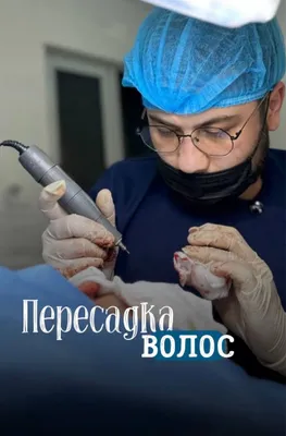 Soch soqol va qosh ekish