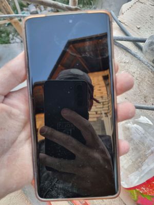 honor x9c holati zur 2 oy buldi dakmunt bor