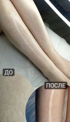 Депиляция с Воском И Шугаринг