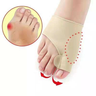 Hallux Valgus Katta oyoq barmoqlarini chiqqan suyagini davolash uchun bunion