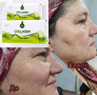 Collagen eliksir molodosti