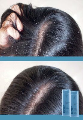 Шампунь-бальзам против перхоти 2 в 1 Expert Hair Advanced Care