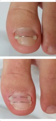 Мужской маникюр педикюр