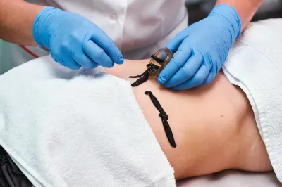 Мануальная терапия, иглоукалывание, хиджама