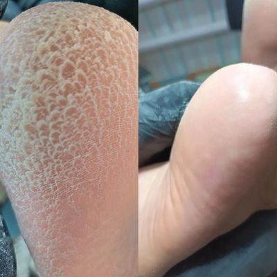 Arzon pedicure manikyur