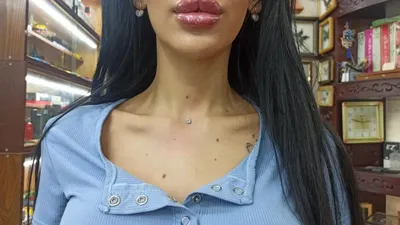 Установка украшения, микродермалл РЕКЛАМИРОВАТЬ ПОДНЯТЬ Частное лицо