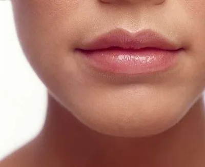 Увеличение губ. Контурная пластика и коррекция губ.