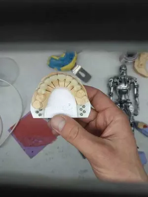 CAD/CAM технология зубного техника