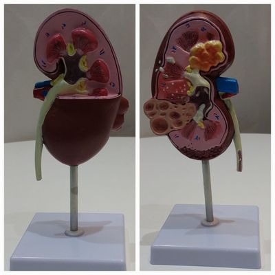 Муляж почки норма и патологии в одном муляже buyrak kidney В наличи