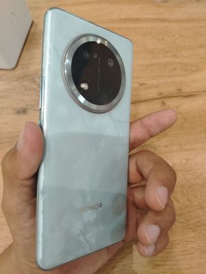 Honor x9c 6600 amper sotiladi yangiday