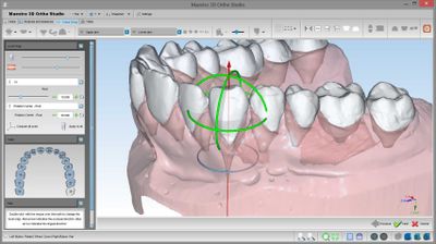 Maestro 3D Dental v6.0, Маэстро 3Д дентал в6