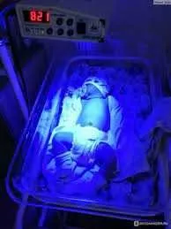 Фотолампа, лечение желтушки у новорожденных