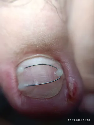 Подолог Сергели.