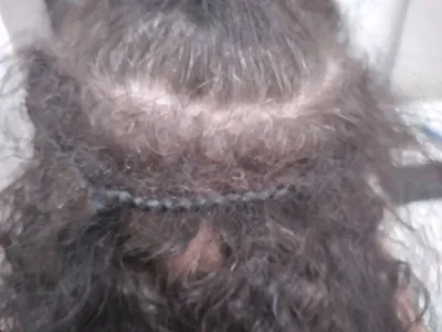 Распутаем калтуны!