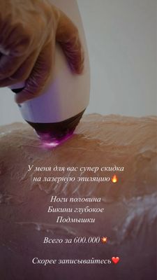 Лазерная эпиляция ташкент