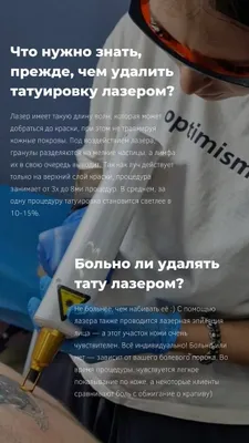 Удаление татуировок любой сложности от 200 тысяч сум