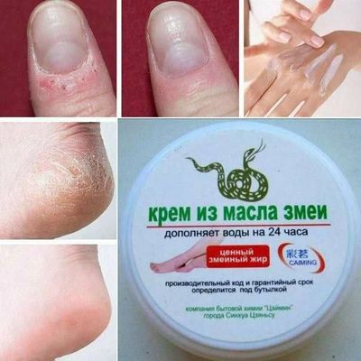 Крем лечебный для рук и ног