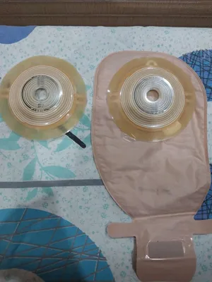 Калоприйомник конвексный