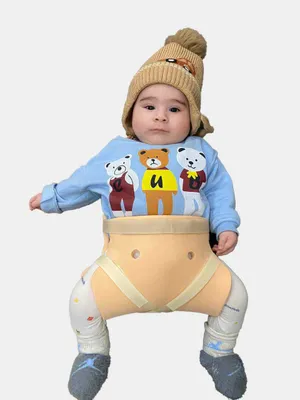 Chaqaloqlar uchun Shina freyka ( Displaziya )