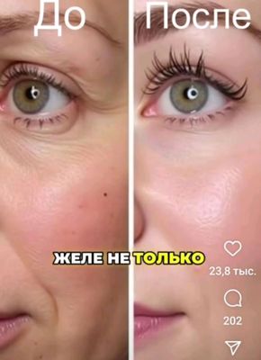АНИОТОТЕРАПИЯ С АППАРАТОМ ВЕНТУН 1.0