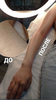 Депиляция воском для мужчин и женщин