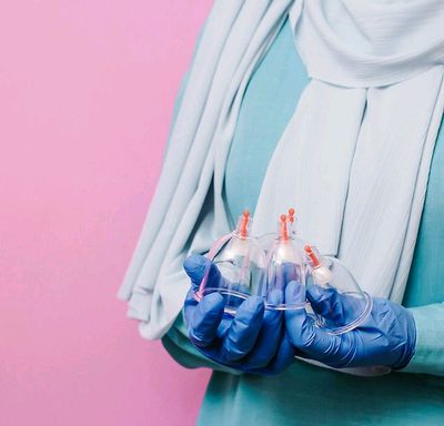 Hijama