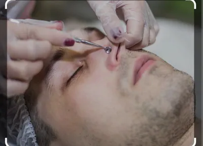 Депиляция все зоны мужская эпиляция