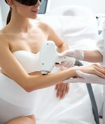 Лазерная эпиляция