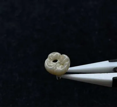 CAD/CAM – компьютерное моделирование зуботехнические услуги