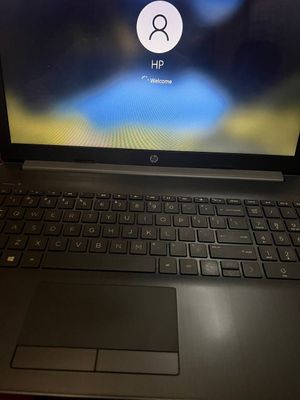 Hp notbook holati ideal ekranni qolda boshqarsa boladi