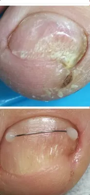 Мужской педикюр маникюр