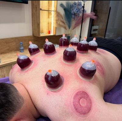 xijoma hijama uyga chaqruv