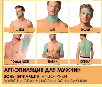 Лаезрная Эпиляция для Мужчин. AFT Удаление волос.