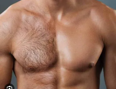 Депиляция Эпиляция лазерная