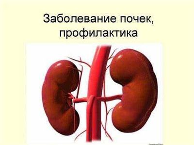 Видео, статьи на диске, Заболевания почек, профилактика