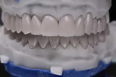 Фрезерный центр CAD/CAM Зуботехническая лаборатория