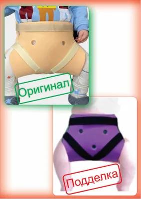 Шина фрейка при дисплазии (ОРИГИНАЛ)