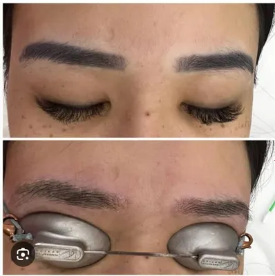 Удаление татуажа бровей.Татуаж учириш.