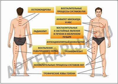 Апитерапия-асал ари билан даволаш