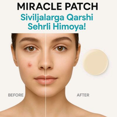 husun buzar uchun patch