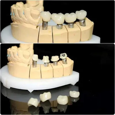 Зуботехническая CAD/CAM услуги в стоматологии