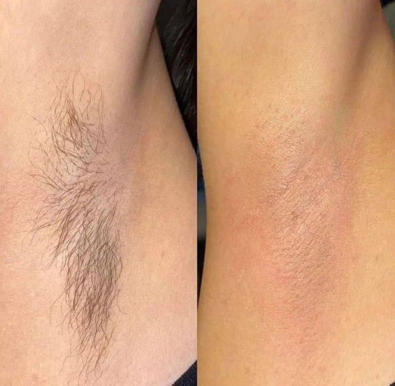 Депиляция для женщин Депиляция для женщин