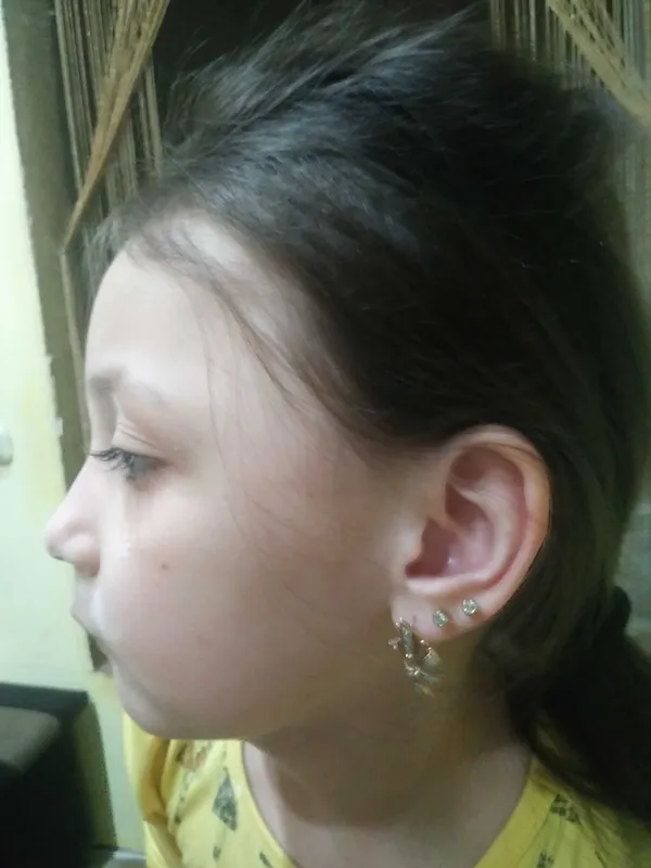 Безболезненное прокалывание ушей Безболезненное прокалывание ушей