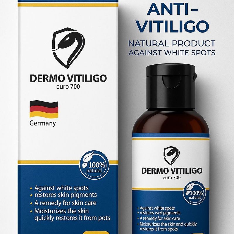 Vitiligo Lasyon New Vitiligo Lasyon New